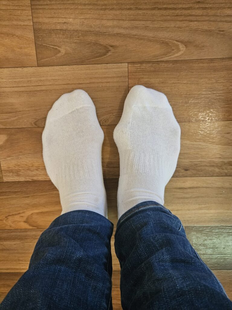 hallux-valgus